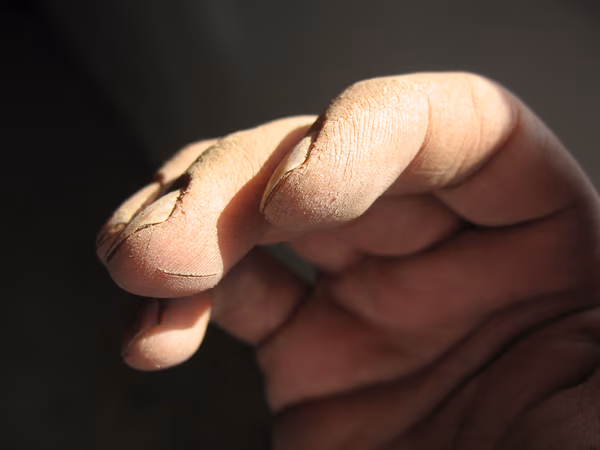 Dirty Hand Detail